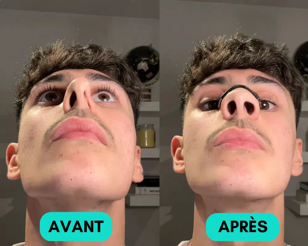 Bandes nasales magnétiques avec dilatateurs